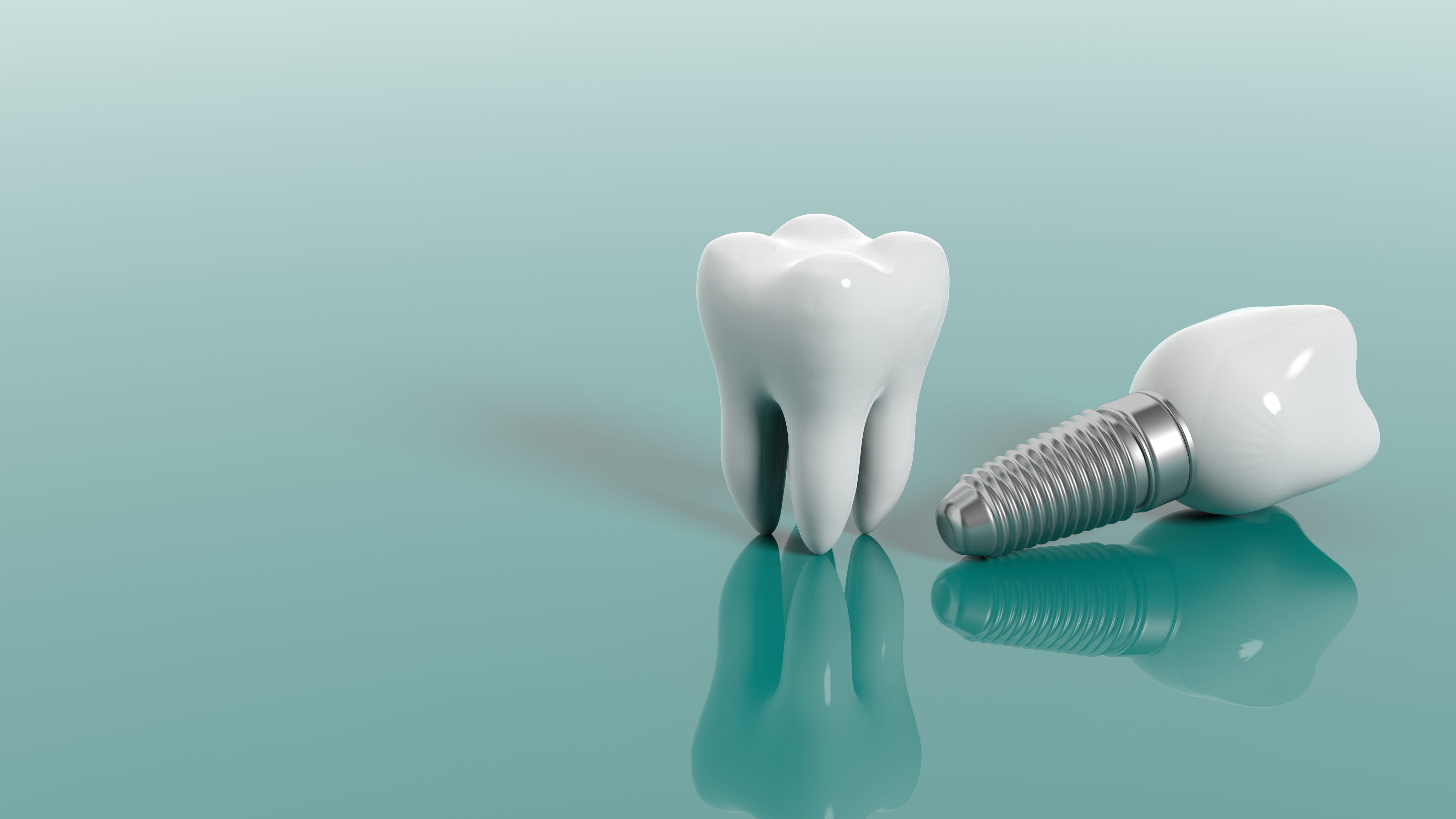 Dental implant placement